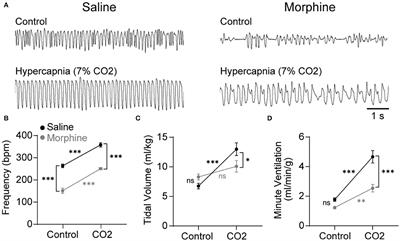 Nucleus Tractus Solitarius Neurons Activated by Hypercapnia and Hypoxia Lack Mu Opioid Receptor Expression